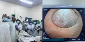 Mu bitaro bya CHUK: Umwana w’amezi 18 yakuwemo igiceri yari amaranye ukwezi mu nda – AMAFOTO