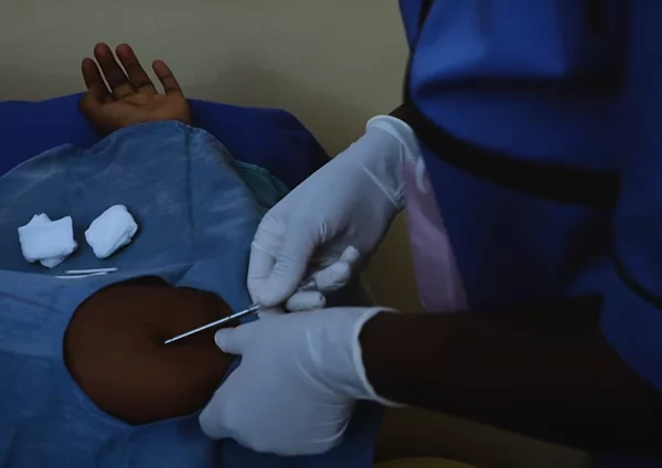 Shyiramo witurize – Sobanukirwa imikorere y’agapira gashyirwa mu kuboko mu kuboneza urubyaro