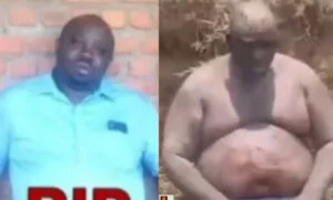 Kigali: Pasiteri birakekwa ko yafashe umugore we asambana agahita yitwikisha Esanse
